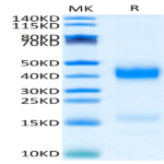 Human Azurocidin/CAP37/AZU1/HBP Protein (HBP-HM101)