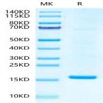 Hepatitis B Virus (HBV) (ayw/France/Tiollais/1979) Capsid Protein (HBV-VE101)