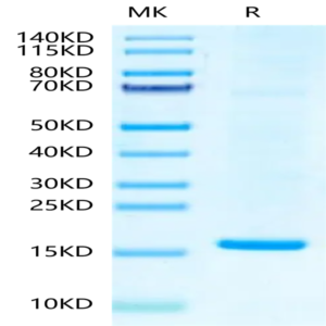 Hepatitis B Virus (HBV) (ayw/France/Tiollais/1979) Capsid Protein (HBV-VE101)