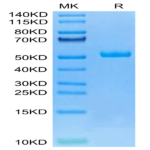 Canine HE4 Protein (HE4-DM204)