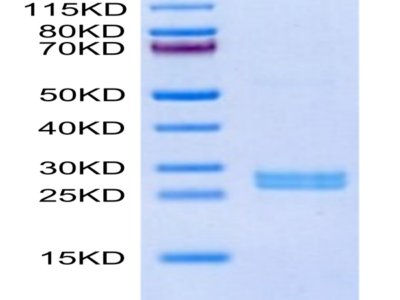 Human Hepcidin/HAMP Protein (HEP-HE601)