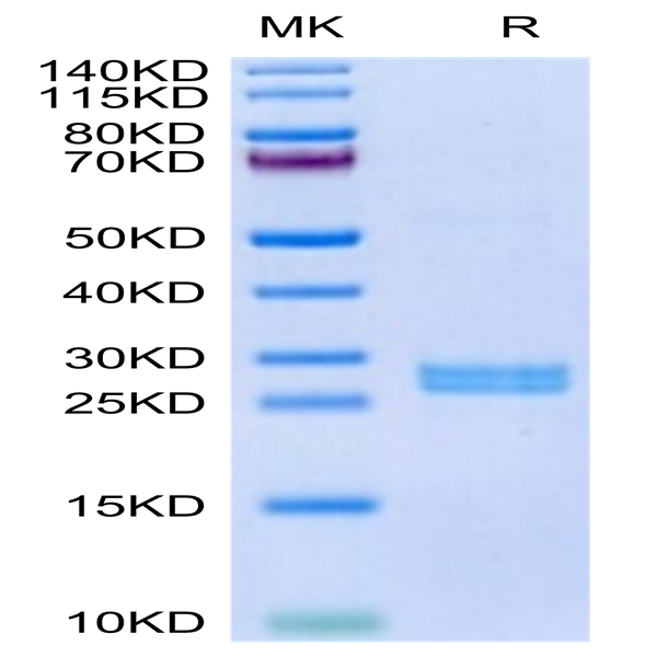 Human Hepcidin/HAMP Protein (HEP-HE601) Human Hepcidin/HAMP Protein (HEP-HE601)