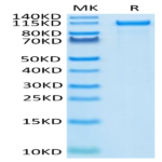 Human Her2/ErbB2 Protein (HER-HM202)