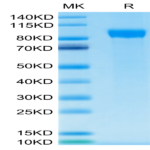 Human Her2/ErbB2 Protein (HER-HM402)