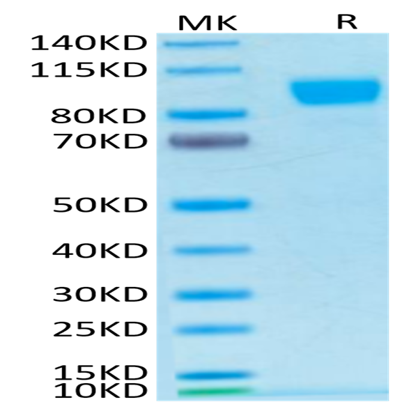 Biotinylated Human Her2/ErbB2 Protein (HER-HM402B)