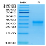 Human Her2/ErbB2 Domain 4 Protein (HER-HM404)