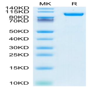 Human HGFA Protein (pro form) (HGF-HM10A)