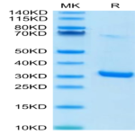 Human HMGB1 Protein (HMG-HM1B1)