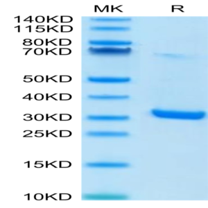 Human HMGB1 Protein (HMG-HM1B1)