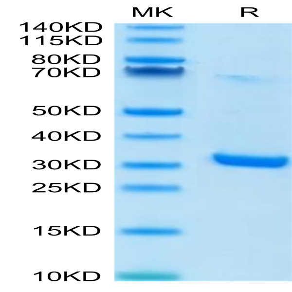 Human HMGB1 Protein (HMG-HM1B1)