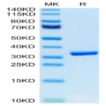 Biotinylated Human HMGB1 Protein (Primary Amine Labeling) (HMG-HM1B1B)