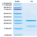 Human HPN Protein (HPN-HM101)
