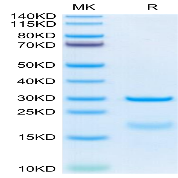 Human HPN Protein (HPN-HM101)