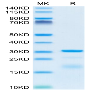 Mouse HPN Protein (HPN-MM101)