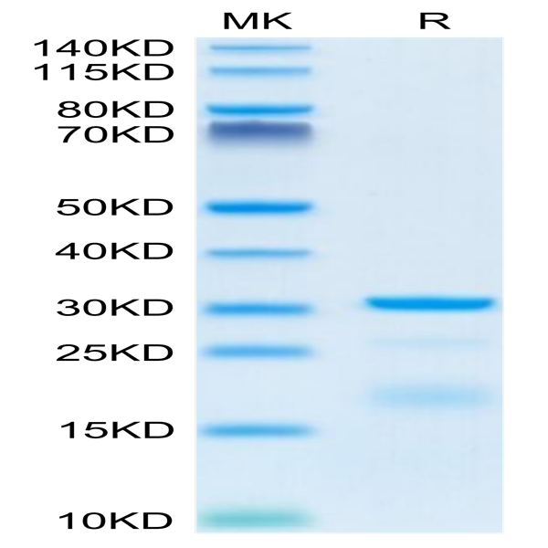 Mouse HPN Protein (HPN-MM101)