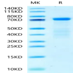 Human HRG/HPRG Protein (HRG-HM101)