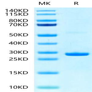 Human Hsp27/HSPB1 Protein (HSP-HE001)
