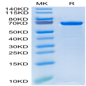 Human HSP70 Protein (HSP-HE170)