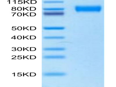 Biotinylated Human/Mouse/Goat Cpn10/HSPE1 Protein (HSP-HE4E1B)
