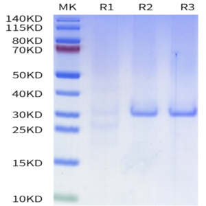 Human HTRA1 Protein (HTR-HE1A1)