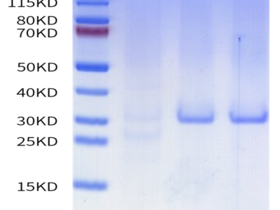 Human HTRA1 Protein (HTR-HE1A1)