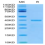 Human HTRA1 Protein (HTR-HE1A1)