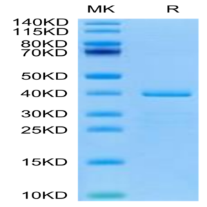 Human HTRA1 Protein (HTR-HE1A1)