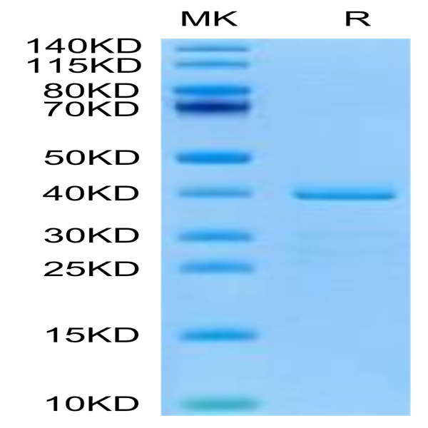 Human HTRA1 Protein (HTR-HE1A1)