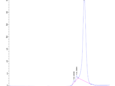 Human Hyaluronidase 2/HYAL2 Protein (HYA-HM101)