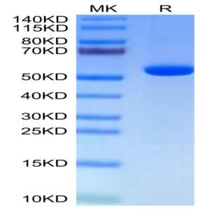 Human Hyaluronidase 2/HYAL2 Protein (HYA-HM101)