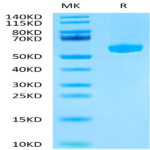 Mouse Hyaluronidase 2/HYAL2 Protein (HYA-MM101)