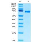 Human ABO Protein, ABO-HM201