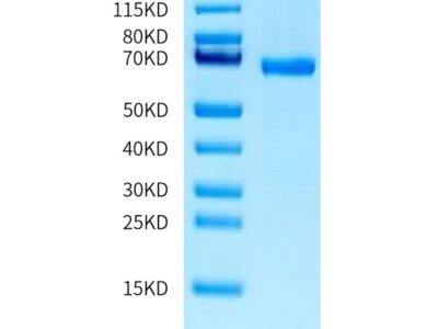 Human ABO Protein, ABO-HM201 Ushelf