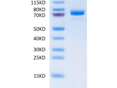 Human ANGPTL7/CDT6 Protein , ANG-HM2L7 Ushelf