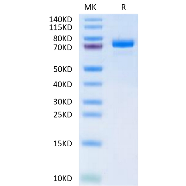 Human ANGPTL7CDT6 Protein , ANG-HM2L7 Human ANGPTL7/CDT6 Protein , ANG-HM2L7 Ushelf