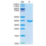 Human ANXA1 Protein , ANX-HE1A1