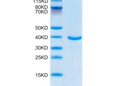 Human ANXA1 Protein , ANX-HE1A1 Ushelf