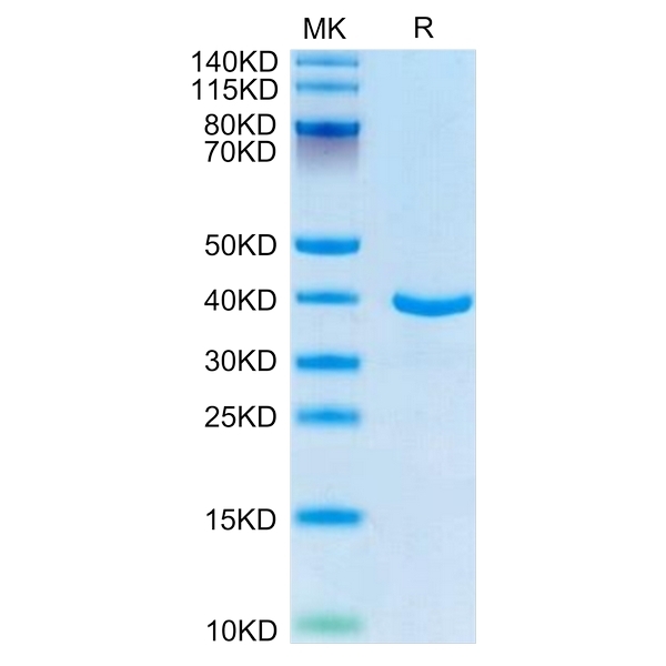 Human ANXA1 Protein , ANX-HE1A1 Ushelf