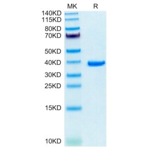 Human ANXA2 Protein , ANX-HE102 Ushelf