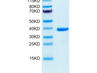 Human ANXA2 Protein , ANX-HE102 Ushelf