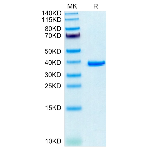 Human ANXA2 Protein , ANX-HE102 Human ANXA2 Protein , ANX-HE102 Ushelf