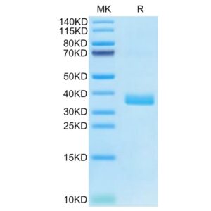 Human APOE4/Apolipoprotein E Protein , APO-HM102 Ushelf