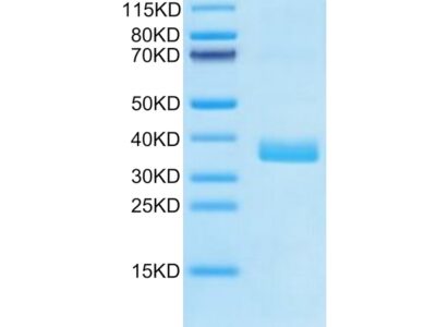 Human APOE4/Apolipoprotein E Protein , APO-HM102 Ushelf