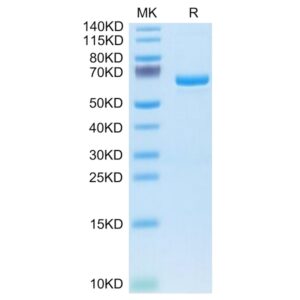 Human APOE4/Apolipoprotein E Protein , APO-HM202 Ushelf