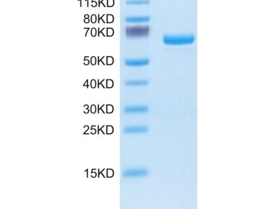 Human APOE4/Apolipoprotein E Protein , APO-HM202 Ushelf