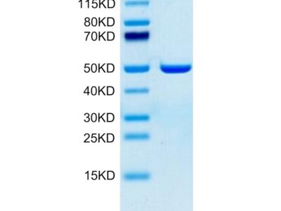 Human ASPH Protein , ASP-HE101 Ushelf