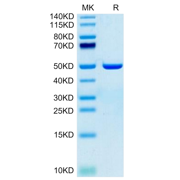 Human ASPH Protein , ASP-HE101 Human ASPH Protein , ASP-HE101 Ushelf
