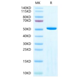 Human Adenylosuccinate Lyase-Protein , ASL-HE001 Ushelf