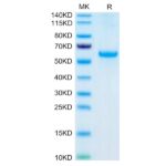 Human AdiponectinAcrp30 Protein, ADI-HM201