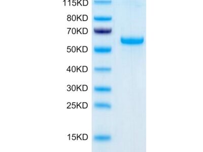 Human Adiponectin/Acrp30 Protein, ADI-HM201 Ushelf